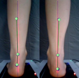 3D foot scanner