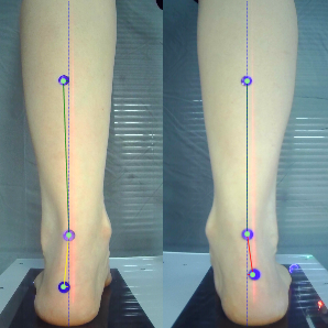 3D foot scanner
