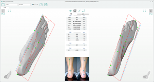 3D foot scanner