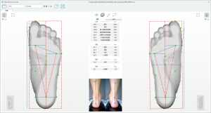 3D foot scanner