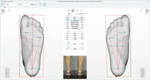 3D foot scanner