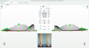 3D foot scanner