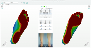 3D foot scanner