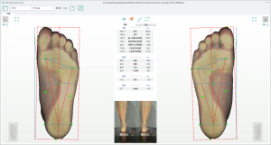 3D foot scanner