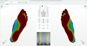 3D foot scanner