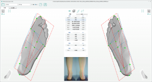 3D foot scanner
