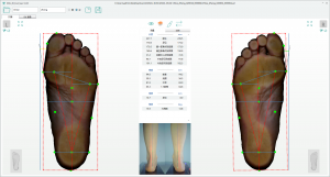 3D foot scanner