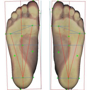 3D foot scanner