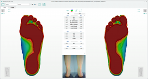 3D foot scanner