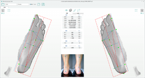 3D foot scanner