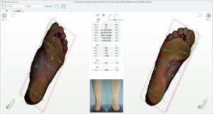 3D foot scanner