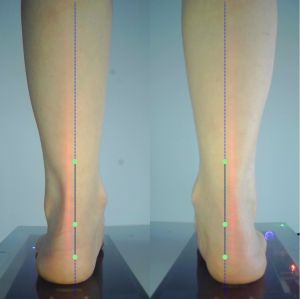 3D foot scanner