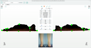 3D foot scanner