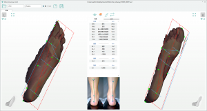 3D foot scanner