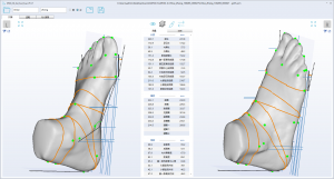 3D foot scanner