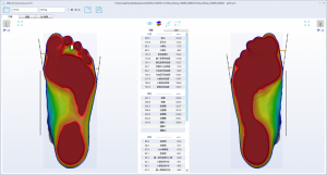 3D foot scanner