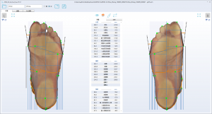 3D foot scanner