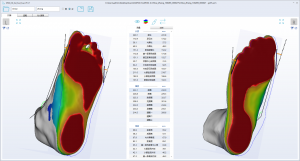 3D foot scanner