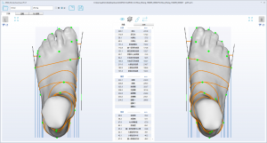 3D foot scanner