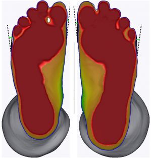 3D foot scanner 三维足部扫描仪